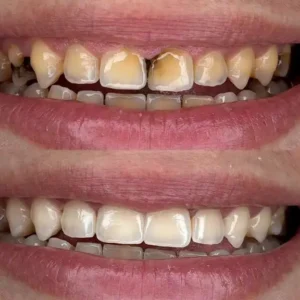 Gum Protect Repair Gel - Image 7
