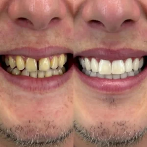 Gum Protect Repair Gel - Image 8