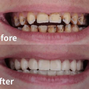 Gum Protect Repair Gel - Image 9