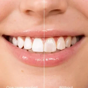 Smileasegot Tooth Polisher – Instantly Brighter Smile - Image 4