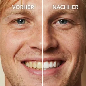 Tooth Polish - Instant Clean Smile - Image 2