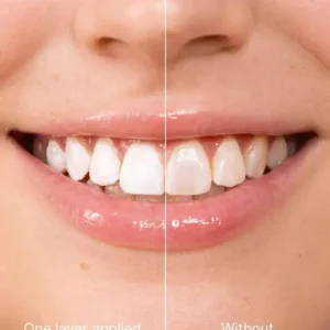 Tooth Polish - Instant Clean Smile - Image 6