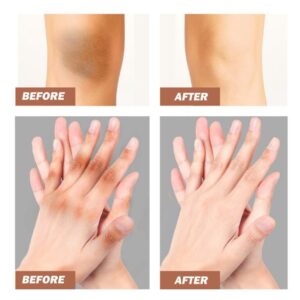 The Most Popular Whitening Cream - Image 5