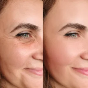 The Natravor Hyaluronic Acid 2% + B5 - Image 6