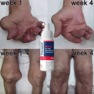 Joint and Bone Therapy Gel - Image 5