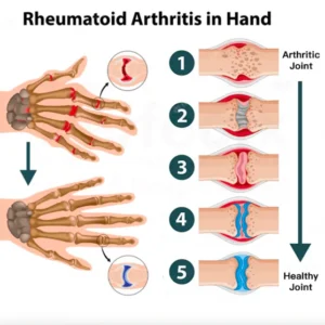 Joint and Bone Therapy Gel - Image 4