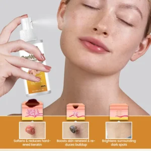 BeeVenom Wart Renewal Spray - Image 4