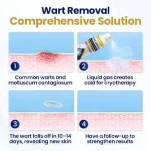 ChillErase Bump Renewal Spray - Image 6