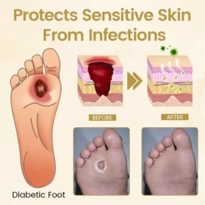 Diabetic Foot Healing Spray - Bee Venom Infused - Image 3