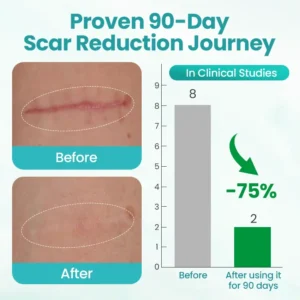 EliteAloe ScarSolve Spray - Image 4