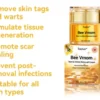 BEE VENOM Wart & Mole Removal Cream