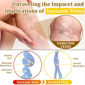 Bee Venom Treatment Cream🐝: Treat Eczema, Psoriasis, Acne, Rosacea, Fungal Infections, Warts - Image 8