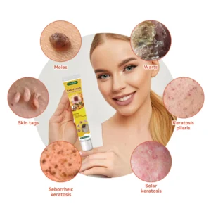 𝐁𝐞𝐞 𝐕𝐞𝐧𝐨𝐦 𝐖𝐚𝐫𝐭 𝐓𝐫𝐞𝐚𝐭𝐦𝐞𝐧𝐭 𝐂𝐫𝐞𝐚𝐦 - Image 7