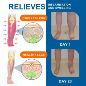 Advanced Lymphatic Drainage Massage Cream - Image 4