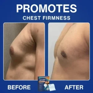 Nano-Microneedle Chest-Sculpt Bio-Patch (𝐉𝐮𝐬𝐭 𝐨𝐧𝐜𝐞 𝐚 𝐝𝐚𝐲, 𝐯𝐢𝐬𝐢𝐛𝐥𝐞 𝐜𝐡𝐚𝐧𝐠𝐞𝐬 𝐢𝐧 𝟕 𝑫𝐚𝐲𝐬 𝐅𝐨𝐫 𝐆𝐲𝐧𝐞𝐜𝐨𝐦𝐚𝐬𝐭𝐢𝐚, 𝐄𝐱𝐜𝐞𝐬𝐬 𝐂𝐡𝐞𝐬𝐭 𝐅𝐚𝐭, 𝐒𝐚𝐠𝐠𝐢𝐧𝐠 𝐒𝐤𝐢𝐧, 𝙇𝙊𝙊𝙎𝗘 𝗦𝗞𝗜𝗡, 𝐚𝐧𝐝 𝐦𝐨𝐫𝐞 - Image 5