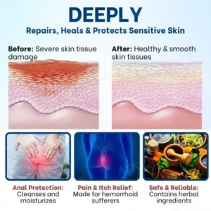 Pruritus Ani Treatment Cream - Image 4