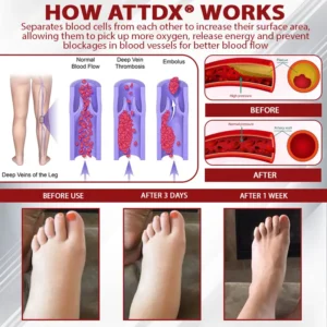Advanced CVI Edema Therapy Cream - Image 5