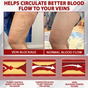 Advanced CVI Edema Therapy Cream - Image 6