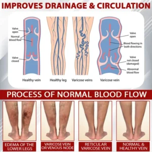 Advanced CVI Edema Therapy Cream - Image 7
