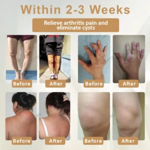 Emu Oil Turmeric Bone Sooth Gel - Image 2