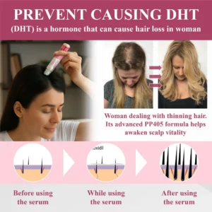 Hair Reawaken PP405 Roll-On Serum for Women - Image 7