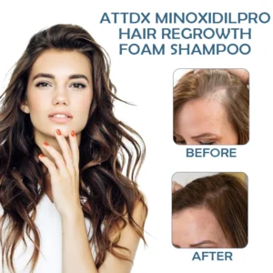 ATTDX MinoxidilPro HairRegrowth FoamShampoo - Image 2