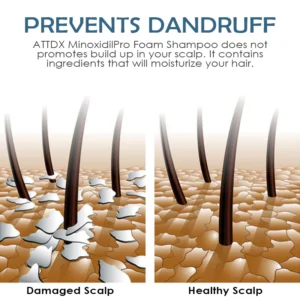 ATTDX MinoxidilPro HairRegrowth FoamShampoo - Image 3