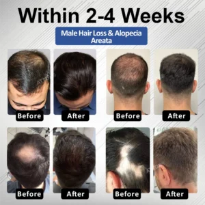 PP405 FolliGen Re-Awaken Hair Spray - Image 3