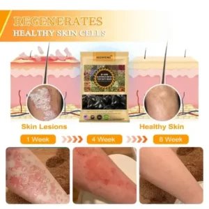 30-Herb Slimming & Detox Foot - Image 12