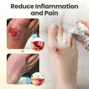 GlucaVeil Foot Shield Spray - Image 10