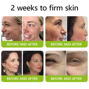 Botox & Retinol Shot - Eraser for deep wrinkles - Image 17