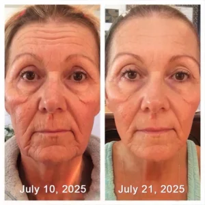 Botox & Retinol Shot - Eraser for deep wrinkles - Image 18
