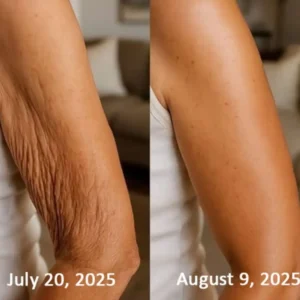 Botox & Retinol Shot - Eraser for deep wrinkles - Image 20