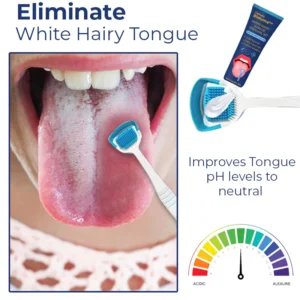 Canada White Hairy Tongue Removal Kit - Image 3