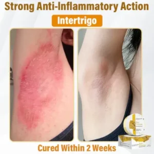 Bee Venom Skin Renewal Cream - Image 9