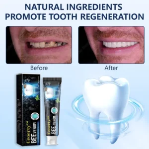 Bee Venom Stain Removal Treatment Toothpaste - Image 4