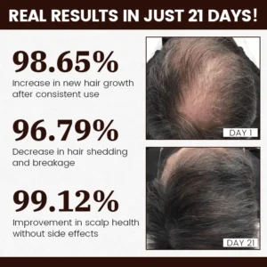 FollicaBoost 5% Minoxidil Hair Care Oil - Image 4