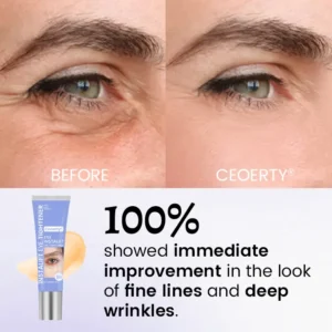 InstaLift Eye Tightener - Image 2