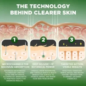 Korean DermaClear Reedle Shot 100 Wart & Mole Serum - Image 6