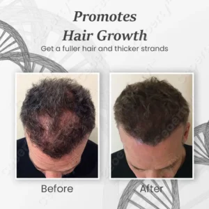 SheddStop Pro-Strength Hair Spray - Image 4