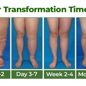 Professional Leg Circulation Cream - Image 3