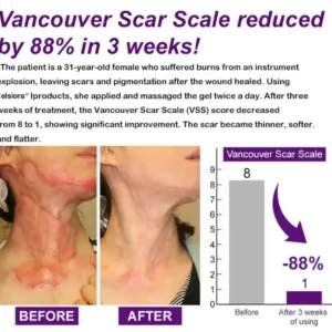Stem Cell Scar Gel - Image 4