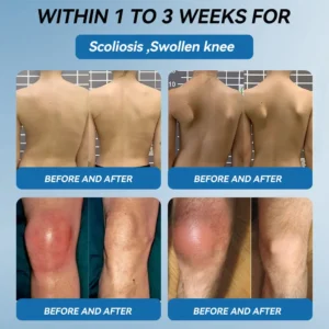 ʙ.ᴘ.ᴄ-157 Joint Healing Cream - Image 3