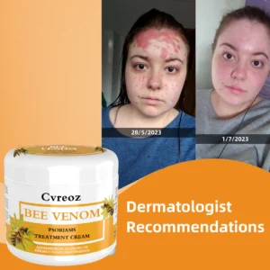 Cvreoz Bee Venom Psoriasis Treatment Cream - Image 3