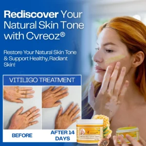 VitiClear Bee Venom Cream - Image 7