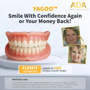 Custom-Fit Full Functional Dentures - Image 3