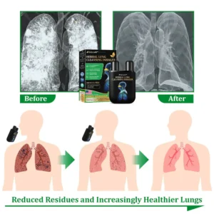 Herbal Lung Cleansing Inhaler - Image 6