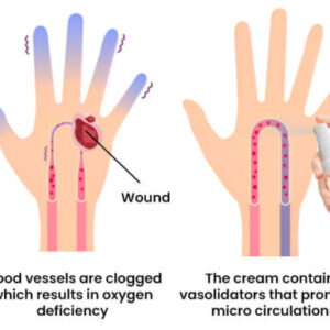 Fast Diabetic Wounds Healing Spray - Image 9