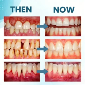 Smilewell Bee Venom Oral Care Powder - Image 4