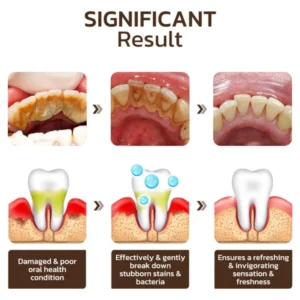 Niacinamide Whitening Toothpaste - Image 5